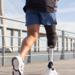 AI prosthetics