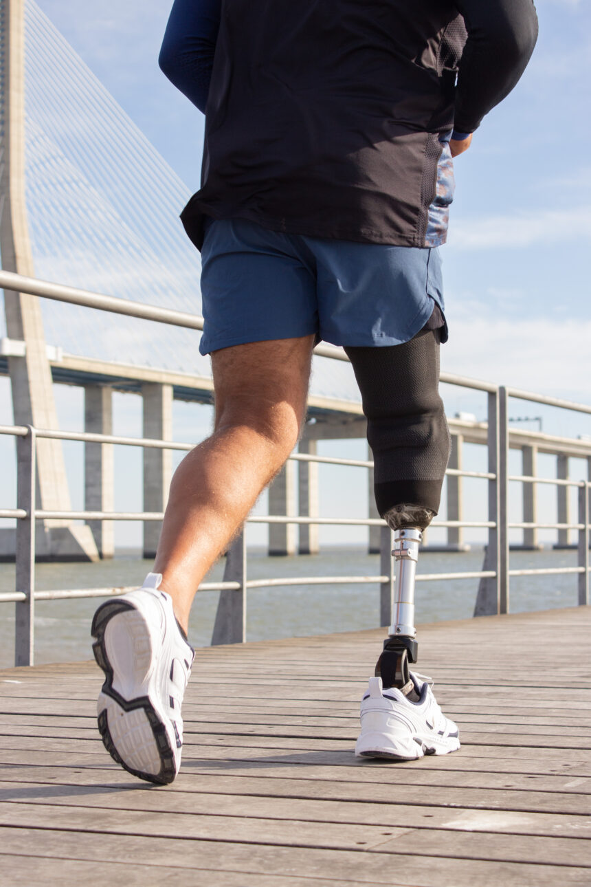 AI prosthetics